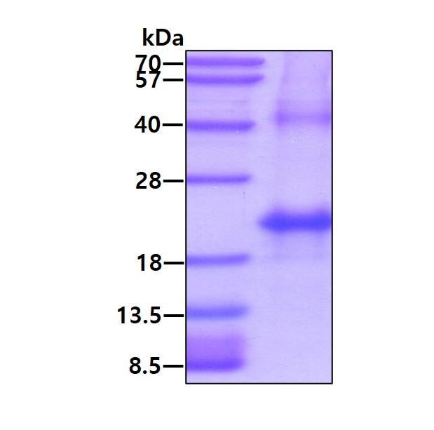 Human Hemoglobin subunit alpha