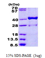 Human Estradiol 17-beta-dehydrogenase 1 (HSD17B1)
