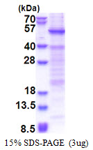 Human Heat Shock Transcription Factor Y-linked 1 (HSFY1)
