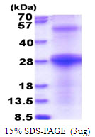 Hepatitis C Virus E2