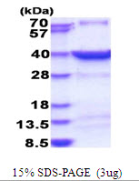 Human Heat Shock Factor 2-Binding Protein (HSF2BP)