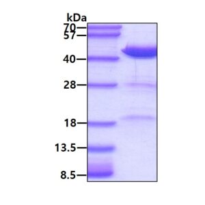 Human Heat Shock 40 kDa Protein (HSP40)