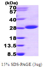 Human Inosine Triphosphate Pyrophosphatase