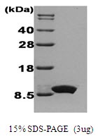 Human Interleukin-8 (IL-8)