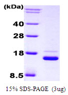 Human IRF1