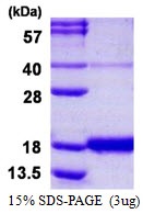 Human Interferon-gamma (IFN-gamma)