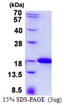 Human IFT20