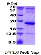 Human Immunoglobulin J Chain (IGJ)