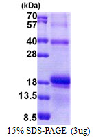 Human Interleukin-17F (IL-17F)