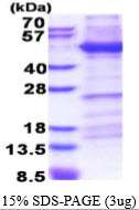 Human Integrin beta-1 (ITGB1)