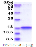Human IMMP2L