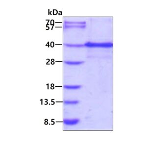 Human Inhibitor of Growth Protein 1 (ING1)