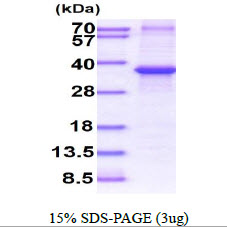 Human IGFBP-3