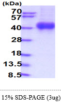 Human IL2 Receptor Gamma (IL2RG)