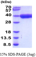 Human IL21 Receptor
