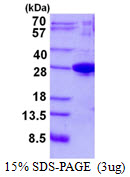 Human Josephin-1 (JOSD1)