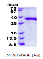 Human Junctional Adhesion Molecule 2/JAM-B