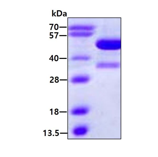 Human KAT2A/GCN5L2