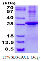 Human Kallikrein-7 (KLK7)