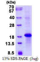 Human KLRC3