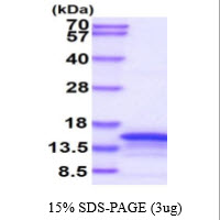 Human Kisspeptin-1 (KISS1)