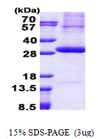 Human Kallikrein-2 (KLK2)