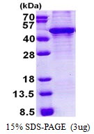 Human Krueppel-like Factor 3 (KLF3)