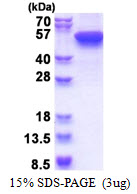 Human Cytokeratin-16 (CK-16)