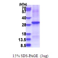 Human Kallikrein-10 (KLK10)