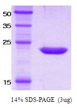 Human KIR2DS4
