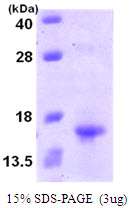 Human Lymphotactin