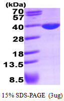 Human LDHA