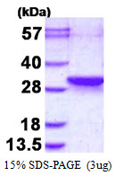 Human LDOC1L