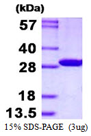 Human Carboxymethylenebutenolidase Homolog