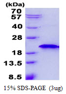 Human E3 Ubiquitin-Protein Ligase RNF181