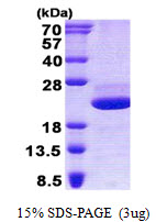 Human Galectin-related Protein (LGALSL)