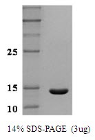 Human Leptin