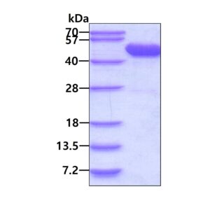 Human MAPK13 (p38 delta)