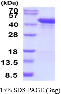 Human Matrix Metalloproteinase-1 (MMP-1)