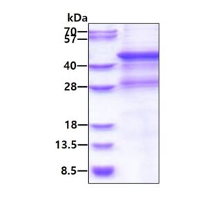 Human Matrix Metalloproteinase-8 (MMP-8)