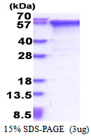 Human Matrix Metalloproteinase-2 (MMP-2)