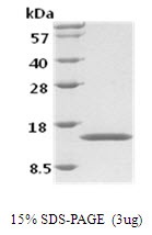 Human Granulocyte-Macrophage Colony Stimulating Factor (GM-CSF)