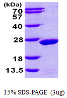 Human Magnesium-dependent phosphatase 1 (MDP1)
