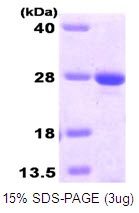 Human O-6-Methylguanine-DNA Methyltransferase (MGMT)