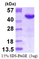 Human MAPK12