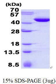 Human MAPKAP Kinase 3