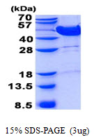 Human Mevalonate Kinase (MVK)
