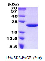 Human Malignant T cell amplified sequence 1