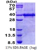 Human Myozenin-1
