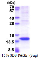 Human Myxovirus Resistance Protein 2 (MX2)